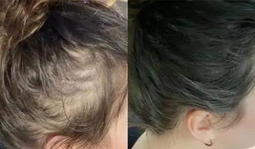 Before and after result