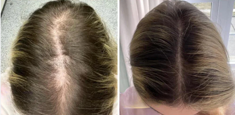 Before and after result