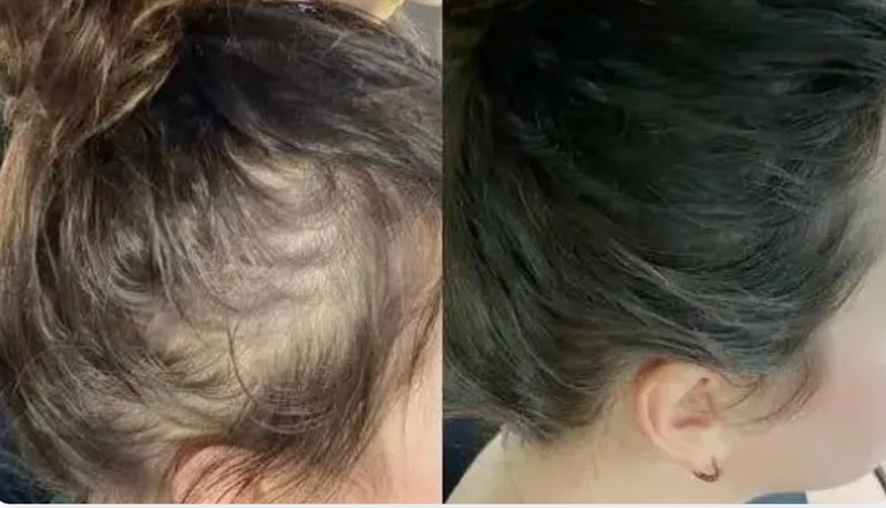 Before and after result